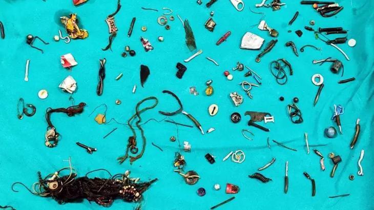 Hepsi midesinden çıktı! Kulaklık, fermuar, cıvata