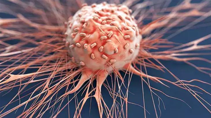 Prostat kanseri: Radyoterapi dozları etkisini azaltabilir