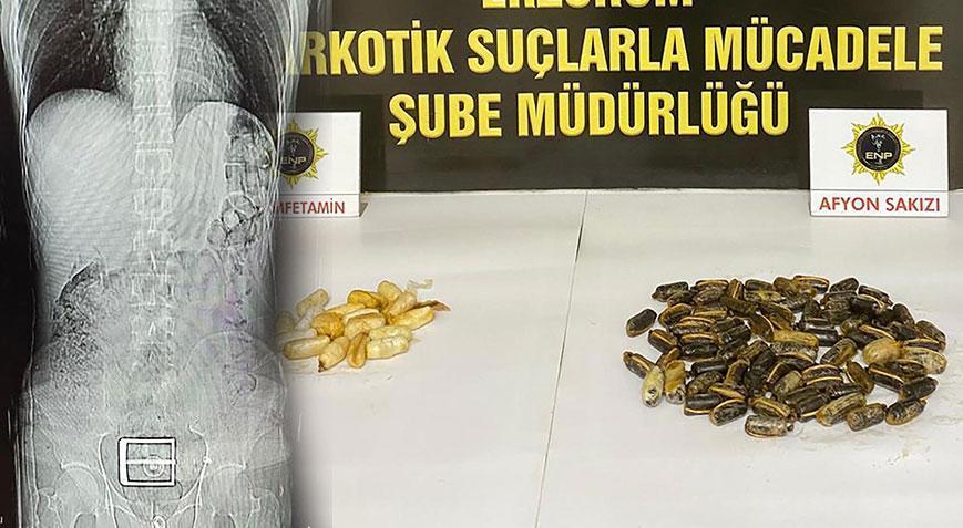 İranlı şüphelinin mide ve bağırsağından çıkan uyuşturucu şoke etti