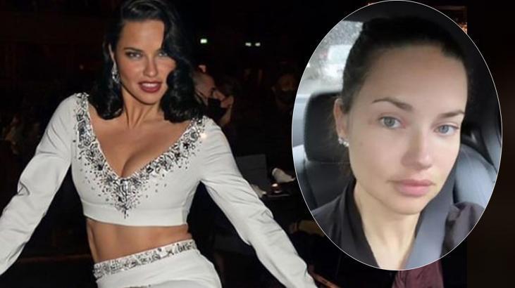 Adriana Lima lüks otelde şoku yaşadı! Tahtakuruları yedi