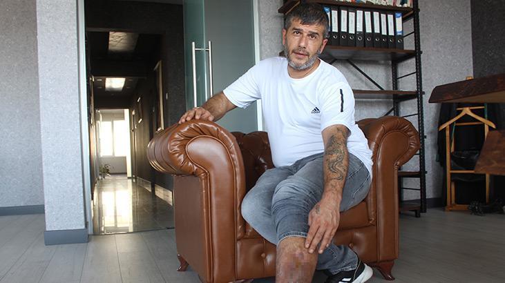 16 yıl önce ameliyat oldu, bacağından kumaş parçası çıktı