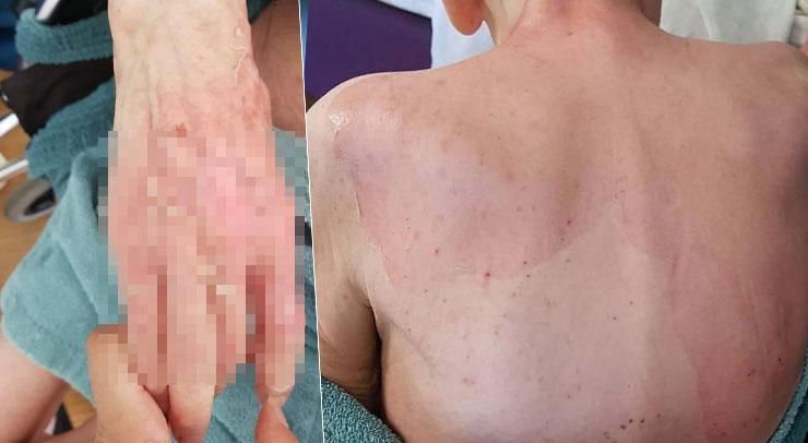 Huzurevinde ölüme götüren iddia! Beklenen rapor geldi