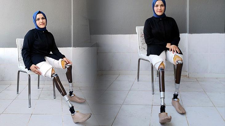 Zeynep İnce yeni protezine kavuşmak istiyor