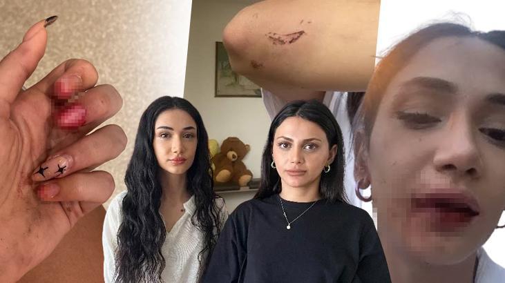 Kısmetse olur Yeliz’i öldüresiye dövmüştü! Cezası belli oldu