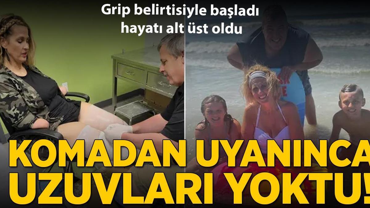 Komadan uyanınca uzuvları yoktu! Grip belirtileriyle başladı, hayatı karardı