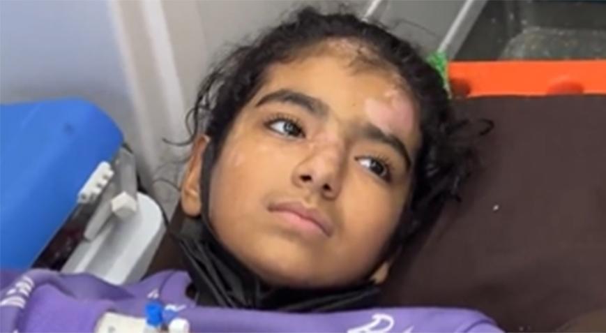 Bakan Koca: Gazzeli 3 çocuk hasta Türkiye’de