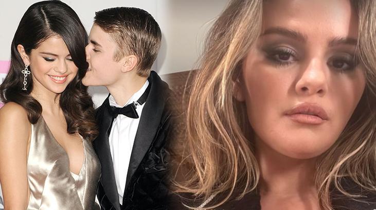 Selena Gomez son haliyle gündem oldu! ’10 yaş yaşlanmış’