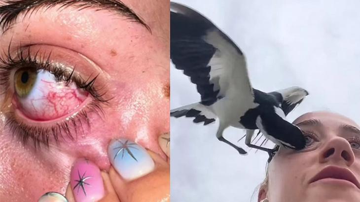 Yürüyüş yaparken saldırdı! Kör olmaktan kılpayı kurtuldu