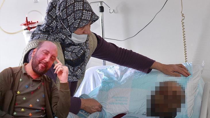 Yağmur ormanlarında yaşayanlarda görülen hastalık! Koronavirüs geçirdikten 1 sene sonra yüzü tanınmaz hale geldi