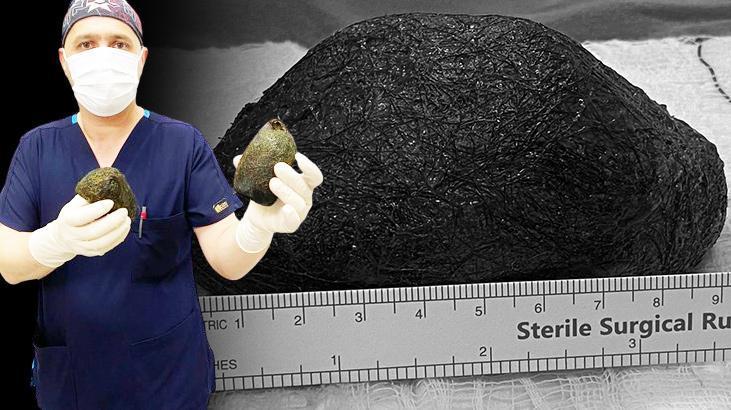 Korkunç alışkanlığı başına bela oldu! Midesinden çıkanlar şok etti