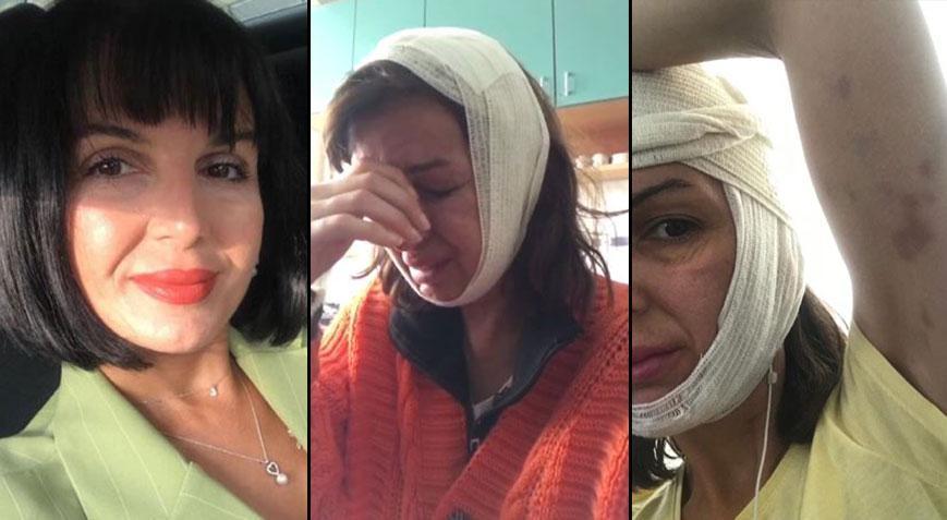 Güzellik salonunda topuklu ayakkabı dayağı! ‘Boks torbasını yumruklar gibi suratına vurmuş’