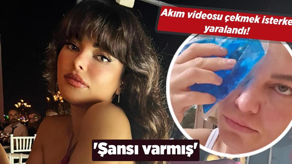 Sinem Umaş akım videosu çekmek isterken yaralandı! ‘Şansı varmış’