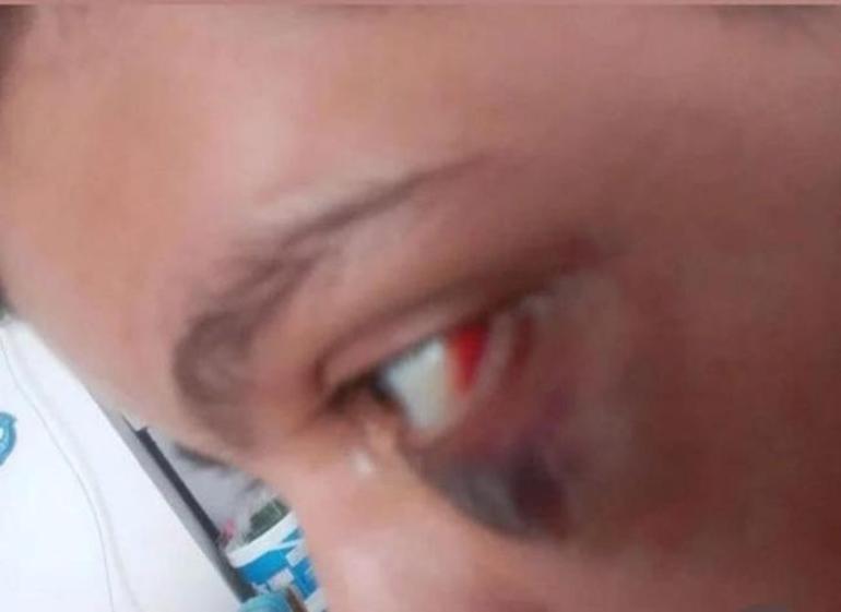 Mersin'de otizmli gence şiddet: Hep doğum günlerinde oluyor
