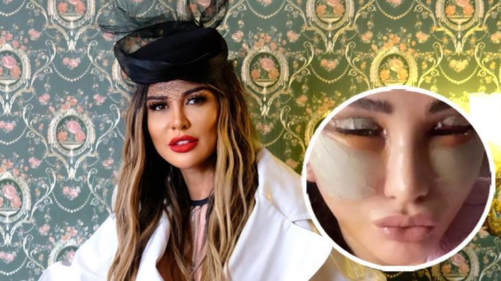 Yüzünü gerdirmişti! Selen Görgüzel son halini paylaştı