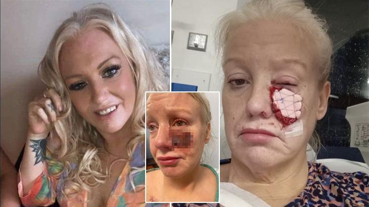 Köpek saldırısı bu hale getirdi! ‘Dişlerini hala içimde hissediyorum’