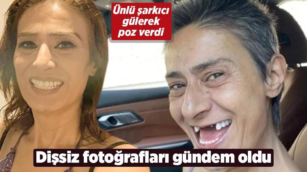 Yıldız Tilbe’den dişsiz fotoğraflar!