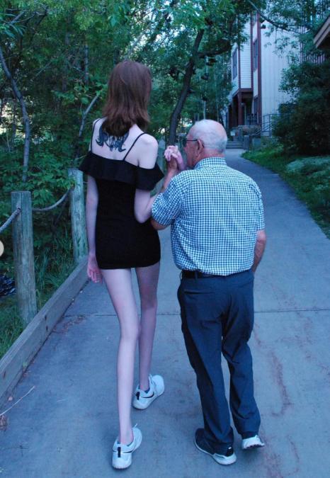 Dünyanın en uzun bacaklı kadını! Sayısız sorunla baş ediyor: Erkekler beni istemiyor