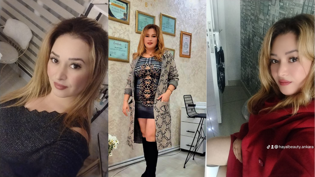 Ankara’da Güzellik Kartları Yeniden Dağıtılıyor: Hayal Beauty Sahneye Çıkıyor!