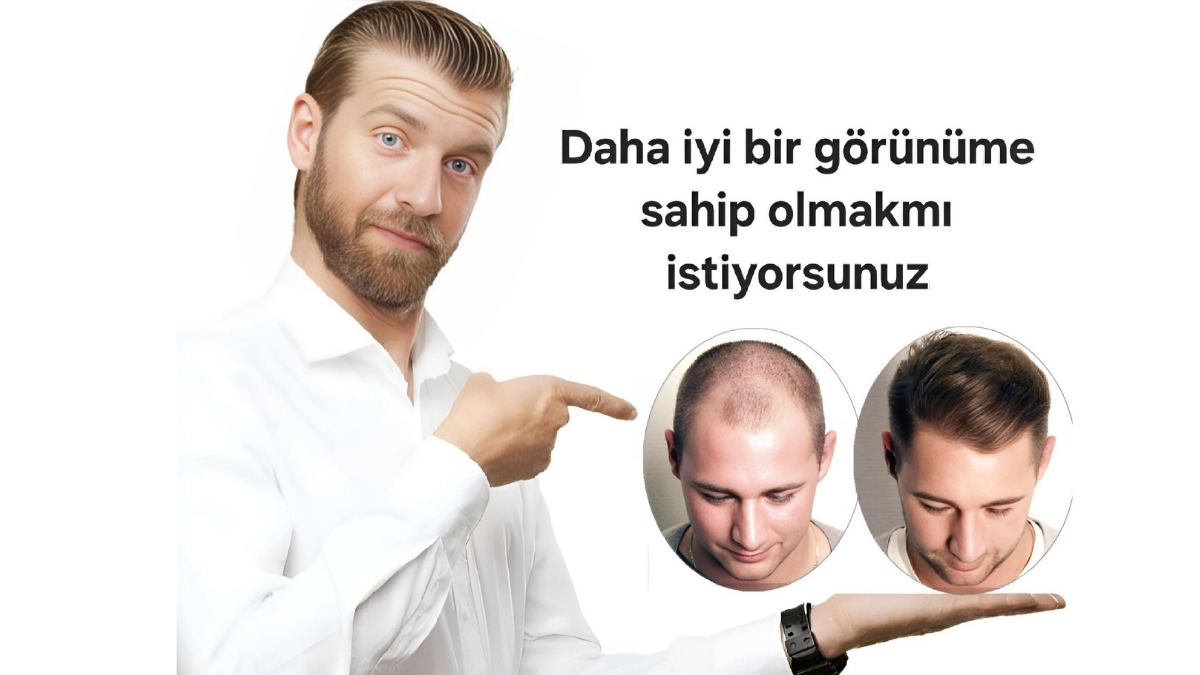 Gold Yöntemi ile Saç Ekimi: Uzm. Est. Yaşar Aykan’dan Serum Destekli, Kalıcı ve Bakım Gerektirmeyen Saçlar