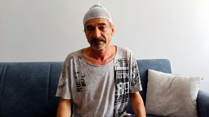 BİNADAN KOPAN BETON PARÇASI BAŞINA DÜŞTÜ: 11 DİKİŞ ATILDI