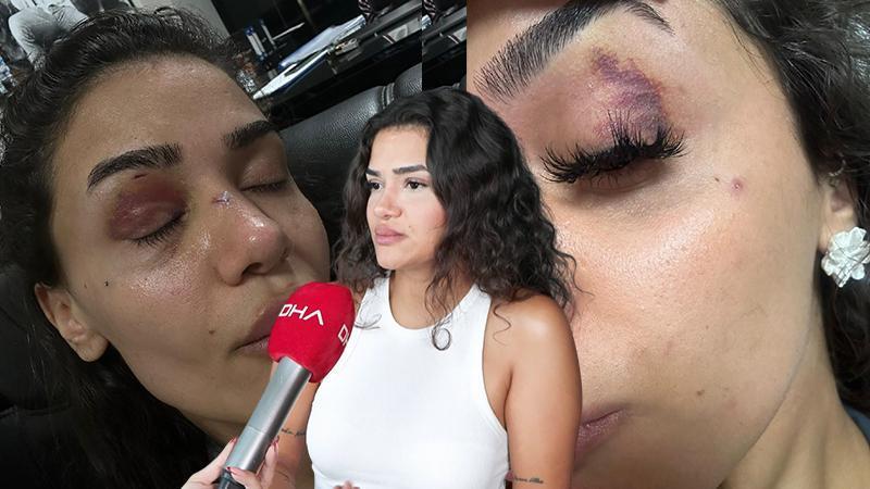 Uzaklaştırma kararına rağmen evinin önünde darbedildi: “Ölmek istemiyorum”